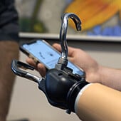ARMS - Hanger Clinic-  Myoelectric & Bionic Prosthetics (1)