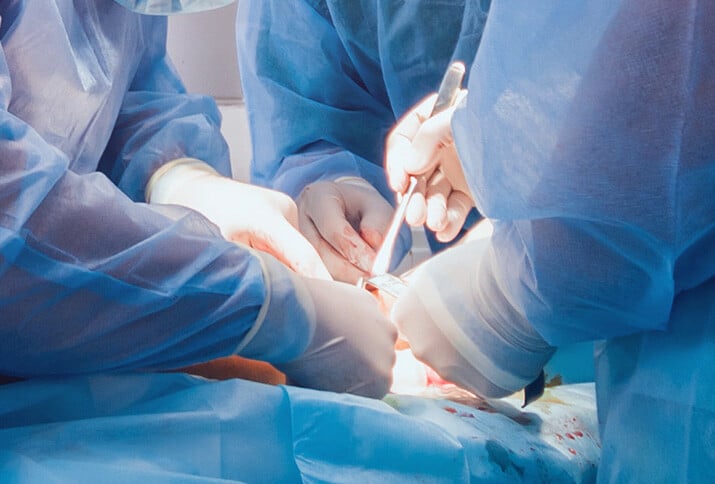 ARMS - Regenerative Peripheral Nerve Interface (RPNI) (T3) - During Surgery