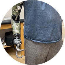 ARMS-prosthetics