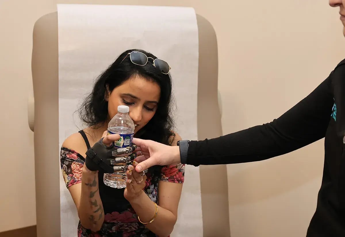 HUES-Prosthetic-Training-Optimization