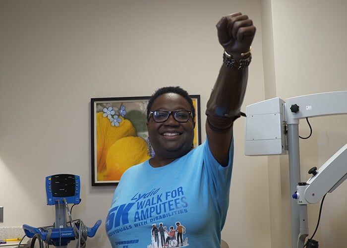 woman-raising-arm-prosthetics